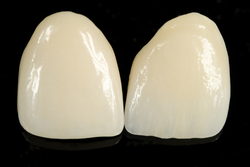 Răng sứ Zirconia